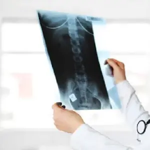 رادیولوژی پزشکی قانونی رشت
